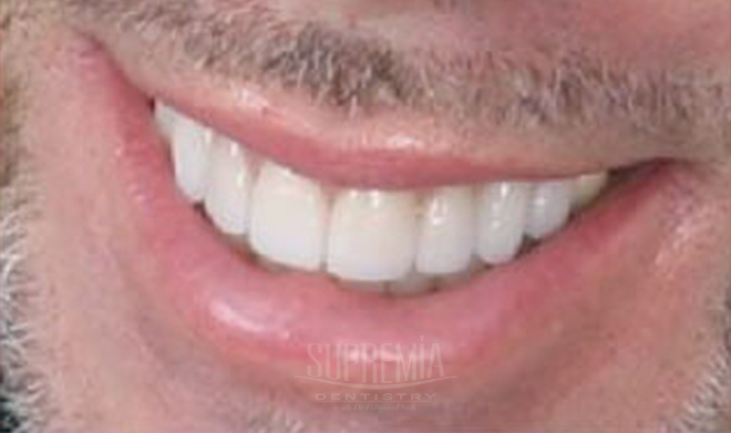 After